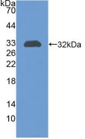 Polyclonal Antibody to Complement Receptor 1, Erythrocyte (CR1)