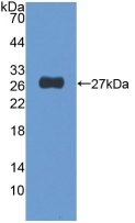 Polyclonal Antibody to Nucleoporin 155 (NU<b>P155</b>)