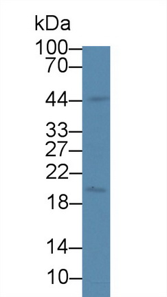Polyclonal Antibody to Androgen Induced Protein 1 (AIG1)