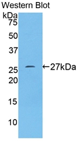 Polyclonal Antibody to Transferrin Receptor (TFR)