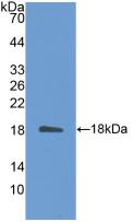 Polyclonal Antibody to Interleukin 31 (IL31)