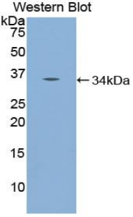 Polyclonal Antibody to Nucleoporin 98 (NUP98)