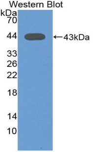 Biotin-Linked Polyclonal Antibody to Aspartate Aminotransferase (AST)