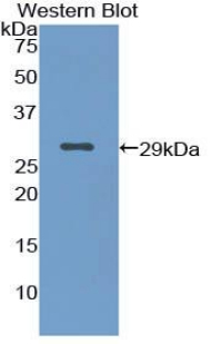 Polyclonal Antibody to Cytokeratin 18 (CK18)