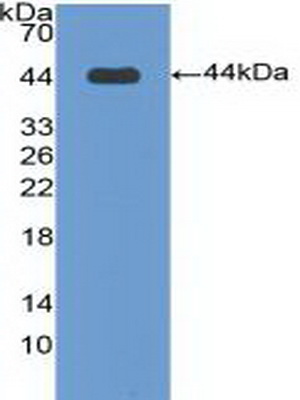 Polyclonal Antibody to Bactericidal/Permeability Increasing Protein (BPI)