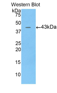 Polyclonal Antibody to Bactericidal/Permeability Increasing Protein (BPI)