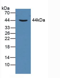 Polyclonal Antibody to Cytokeratin Fragment Antigen 21-1 (CYFRA21-1)