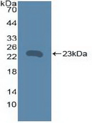 Polyclonal Antibody to Tumor Necrosis Factor Receptor Superfamily, Member 5 (CD40)