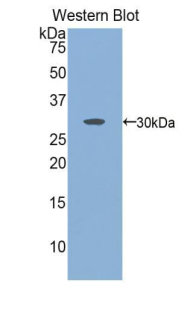 Polyclonal Antibody to Kininogen 1 (KNG1)