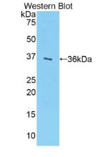Polyclonal Antibody to Sulfotransferase 1A1 (SULT1A1)