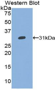 Polyclonal Antibody to Cluster of Differentiation 42d (CD42d)