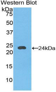 Polyclonal Antibody to Cadherin 5 (CDH5)