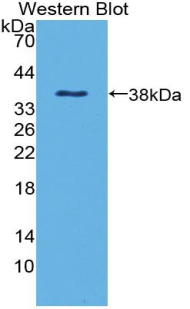 Polyclonal Antibody to Defensin Beta 1 (DEFb1)