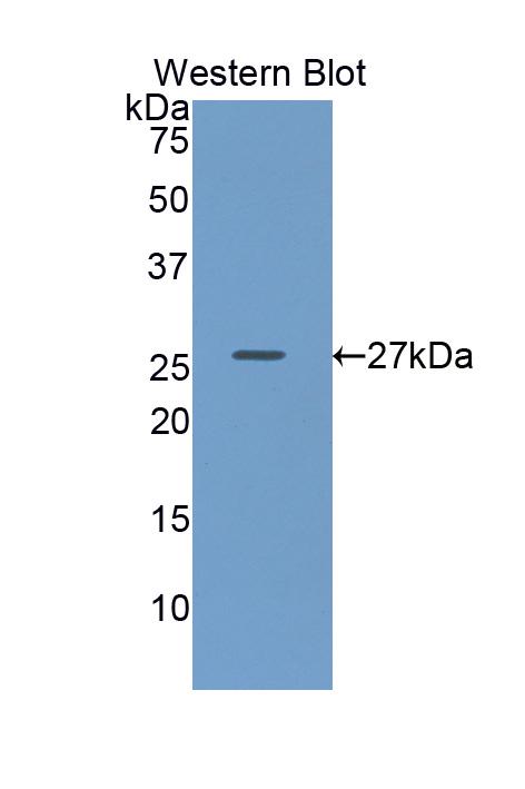 Biotin-Linked Polyclonal Antibody to Glucuronidase Beta (GUSb)