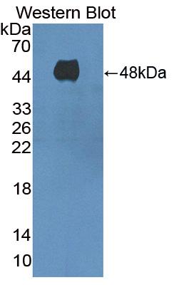 Polyclonal Antibody to Adenylate Cyclase 8, Brain (ADCY8)
