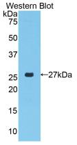 Polyclonal Antibody to Proteinase 3 (PR3)