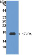Polyclonal Antibody to Relaxin/Insulin Like Family Peptide Receptor 1 (RXFP1)
