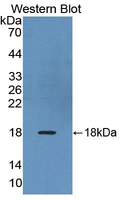 Polyclonal Antibody to Relaxin/Insulin Like Family Peptide Receptor 1 (RXFP1)