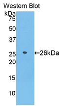 Polyclonal Antibody to Azurocidin (AZU)