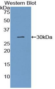 Polyclonal Antibody to Connexin 37 (CX37)