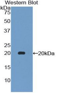 Polyclonal Antibody to Colony Stimulating Factor 2 Receptor Alpha (CSF2Ra)