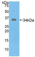 Polyclonal Antibody to Dystrophin (DMD)