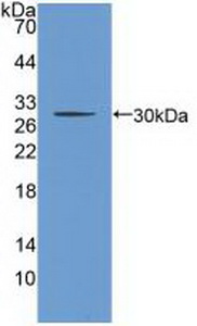 Polyclonal Antibody to Cholinergic Receptor, Nicotinic, Beta 2 (CHRNb2)