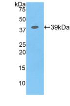 Polyclonal Antibody to Colony Stimulating Factor 2 Receptor Beta (CSF2Rb)