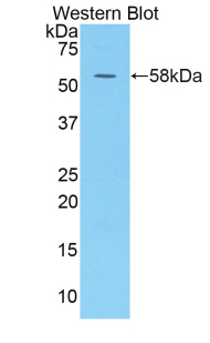 Polyclonal Antibody to Killer Cell Immunoglobulin Like Receptor 3DL1 (KIR3DL1)