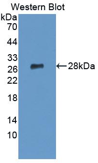 Polyclonal Antibody to Lymphocyte Function Associated Antigen 1 Alpha (CD11a)