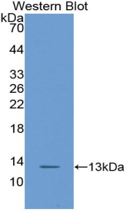 Polyclonal Antibody to Chemokine (C-X-C Motif) Ligand 14 (CXCL14)