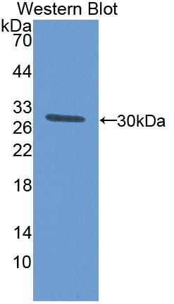 Polyclonal Antibody to Interleukin 17 Receptor A (IL17RA)