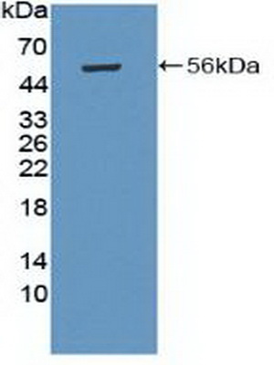 Polyclonal Antibody to Protein Kinase, AMP Activated Beta 1 (PRKAb1)