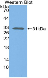 Polyclonal Antibody to Complement Component 1, S Subcomponent (C1s)