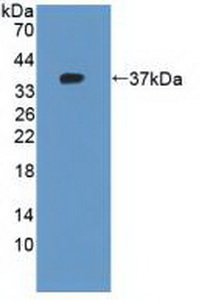 Polyclonal Antibody to Cytokeratin 10 (CK10)
