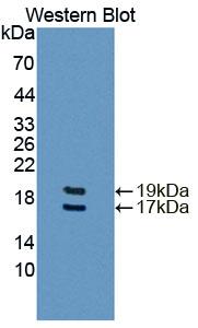 Polyclonal Antibody to Fatty Acid Binding Protein 4 (FABP4)