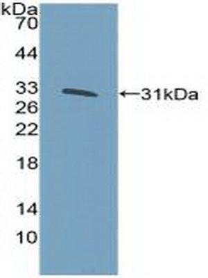 Polyclonal Antibody to Kruppel Like Factor 5, Intestinal (KLF5)