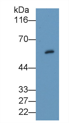 Polyclonal Antibody to Protein Kinase B Beta (PKBb)