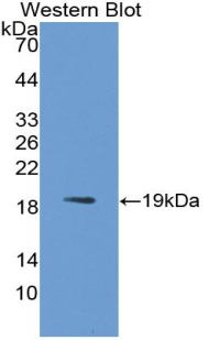 Polyclonal Antibody to Bone Morphogenetic Protein 9 (BMP9)