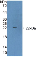 Polyclonal Antibody to Cluster Of differentiation 301 (CD301)