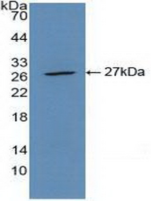 Polyclonal Antibody to Cluster Of differentiation 301 (C<b>D301</b>)