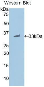 Polyclonal Antibody to Signal Transducer And Activator Of Transcription 1 (STAT1)