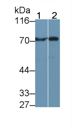 Polyclonal Antibody to Transglutaminase 3, Epidermal (TGM3)