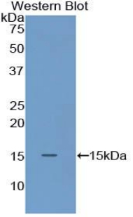 Biotin-Linked Polyclonal Antibody to S100 Calcium Binding Protein A9 (S100A9)