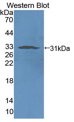 Polyclonal Antibody to Natural Cytotoxicity Triggering Receptor 1 (NCR1)