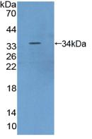 Polyclonal Antibody to Serine/threonine-protein kinase mTOR (mTOR)