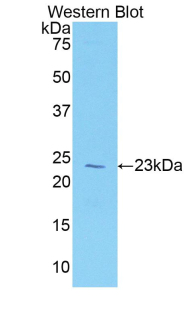Polyclonal Antibody to Vitamin D Binding Protein (DBP)