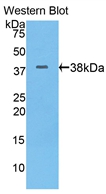 Polyclonal Antibody to Cytokeratin 17 (CK17)