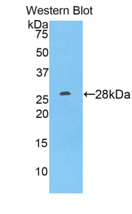 Polyclonal Antibody to A Disintegrin And Metalloprotease 9 (ADAM9)