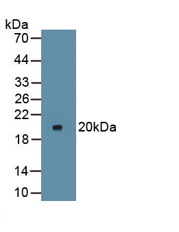 Polyclonal Antibody to Inhibitory Subunit Of NF Kappa B Alpha (IkBa)